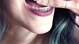 Biting My Fingers - Bite, Mouth, Teeth, Braces, Fetish Ita