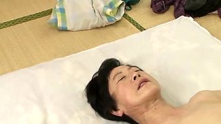 314-youth-with-areare-rmj