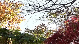 001-youth-with-areare-apd