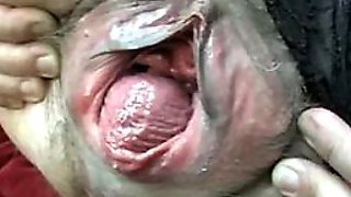 Close Up Video of a Mature Lady's Prolapsing Pussy