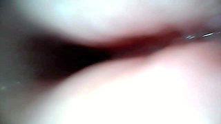 Endoscope Camera Captures Moment of Male Ejaculation 4K